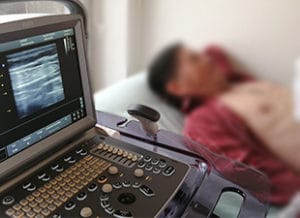 ecografia abdominal Diagnóstico por imágenes ecografia quito 300x218